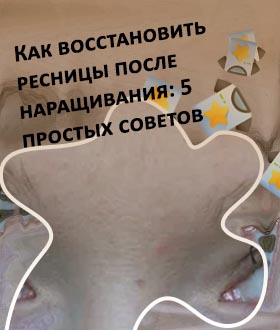 Как восстановить ресниц после наращивания