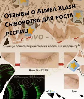 Xlash сыворотка для роста ресниц отзывы